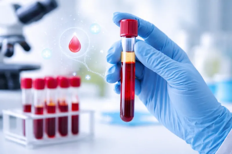 Для чего сдавать анализ крови на глюкозу