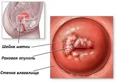 Шейка.jpg Шейка.jpg